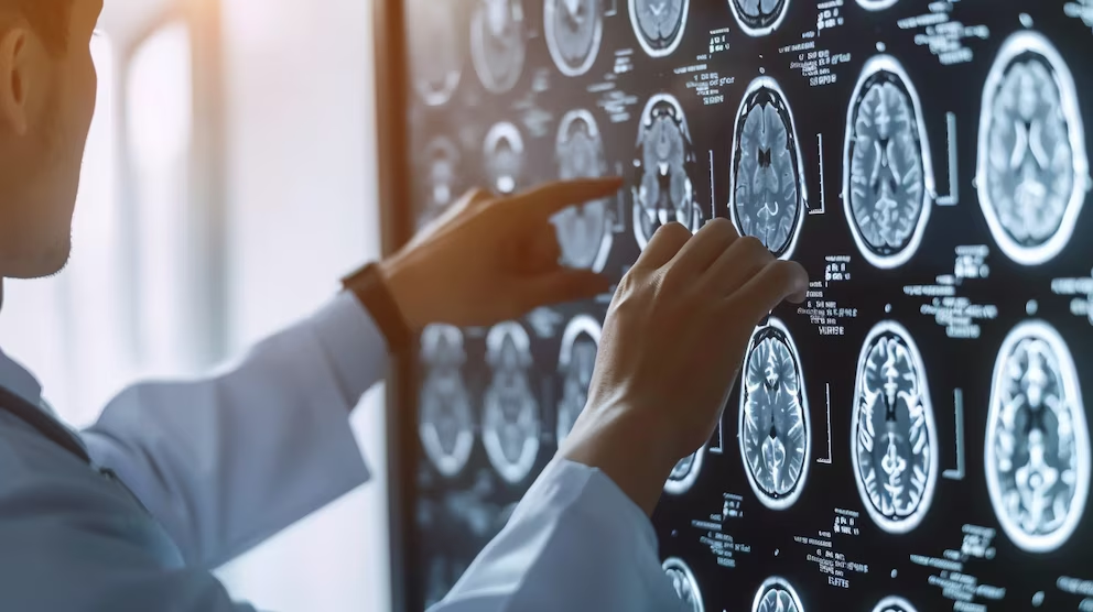 El avance del Conicet que permitirá mejorar el diagnóstico y tratamiento de tumores cerebrales de difícil manejo